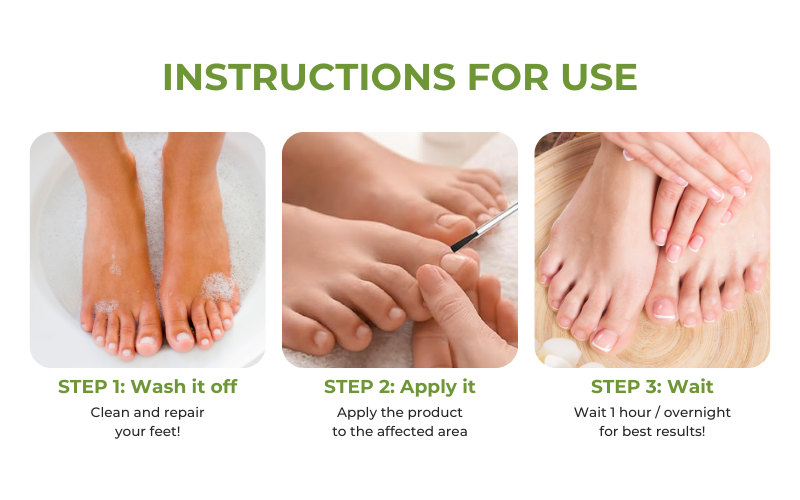 AQA  FungiVanish  Nail Treatment Oil