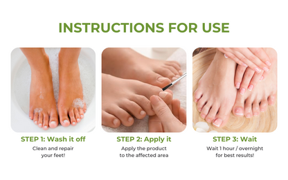 AQA  FungiVanish  Nail Treatment Oil