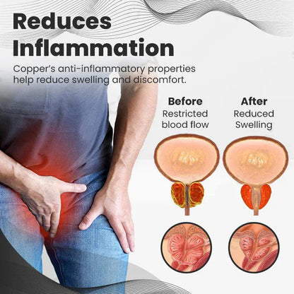 【 ✨Official Brand Store ✨】AQA™ Ringmiz Copper Mag Prostate Therapy Ring（Limited Time Discount 🔥 Last Day）