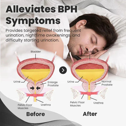 【 ✨Official Brand Store ✨】AQA™ Ringmiz Copper Mag Prostate Therapy Ring（Limited Time Discount 🔥 Last Day）