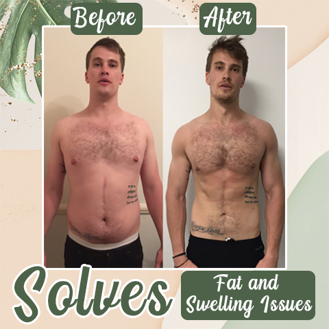 HZA  Perfect Detox Slimming Patch（Limited Time Discount 🔥 Last Day）