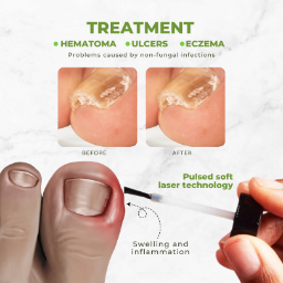 AQA  FungiVanish  Nail Treatment Oil